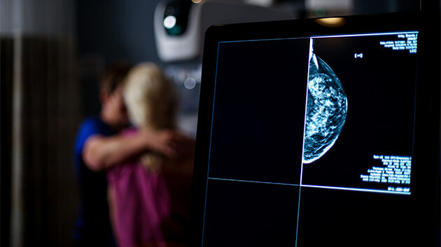 A close up picture of an imaging monitor of a mammogram