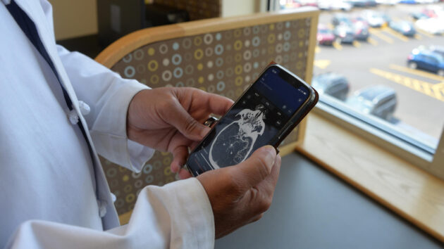 An Albany Med Health System physician looks at a scan on the Viz.ai software on his mobile phone