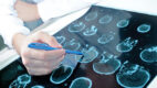 Closeup image of brain scans