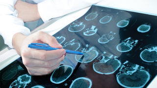 Closeup image of brain scans