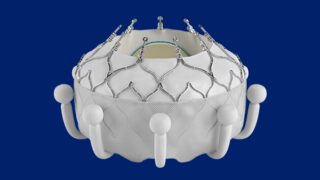 An EVOQUE System tricuspid valve.