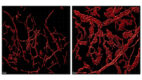 Blood vessels from normal mouse ear skin on the left and from a mouse that has a mutation in its endothelial cells on the right, showing endothelial cells expressing a red fluorescent marker, taken with the Nikon AX R MP microscope.